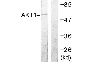 Immunohistochemistry analysis of paraffin-embedded human ovary tissue using Akt (Ab-72) antibody. (AKT1 Antikörper  (Thr72))