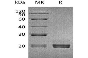 Western Blotting (WB) image for CD40 Ligand (CD40LG) (Active) protein (His tag) (ABIN7320848) (CD40 Ligand Protein (CD40LG) (His tag))