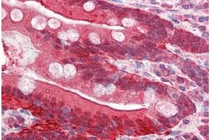 Human Small Intestine (formalin-fixed, paraffin-embedded) stained with FABP2 antibody ABIN337124 at 2. (FABP2 Antikörper  (AA 121-132))