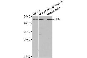 Western blot analysis of extracts of various cell lines, using LUM antibody. (LUM Antikörper  (AA 19-338))