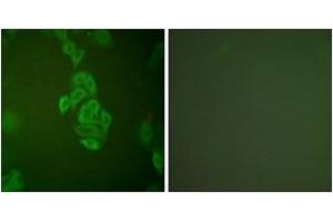Immunofluorescence analysis of A549 cells, using NSE Antibody. (ENO2/NSE Antikörper  (AA 371-420))