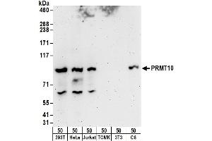 anti-Protein Arginine Methyltransferase 10 (PRMT10) (AA 795-845) antibody