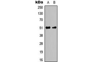 Western blot analysis of Caspase 2 expression in K562 (A), NIH3T3 (B) whole cell lysates. (Caspase 2 Antikörper  (Center))