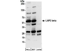 Western Blotting (WB) image for anti-LAP2 beta/tmpo (AA 225-275) antibody (ABIN7455055) (LAP2 beta/tmpo (AA 225-275) Antikörper)