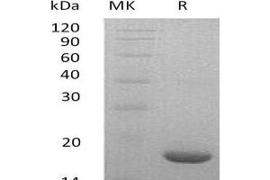 Western Blotting (WB) image for Leukemia Inhibitory Factor (LIF) protein (ABIN7320606) (LIF Protein)