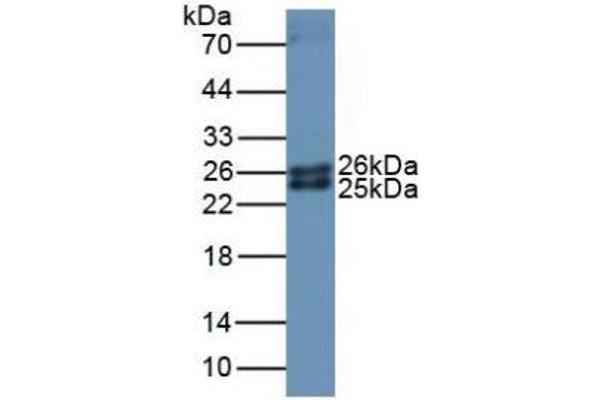 Ferritin Mitochondrial Antikörper  (AA 54-229)