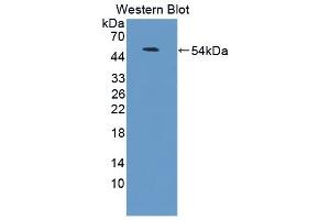 Detection of Recombinant LFA3, Human using Polyclonal Antibody to Cluster Of Differentiation 58 (CD58) (CD58 Antikörper  (AA 1-214))