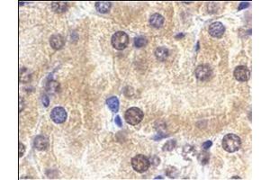 Immunohistochemistry of ST2 in mouse kidney tissue with this product at 2 μg/ml. (IL1RL1 Antikörper  (N-Term))