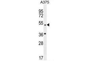 AP1M1 Antibody (Center) western blot analysis in A375 cell line lysates (35µg/lane). (AP1M1 Antikörper  (Middle Region))