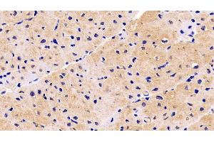 Detection of NRP1 in Human Cardiac Muscle Tissue using Monoclonal Antibody to Neuropilin 1 (NRP1) (Neuropilin 1 Antikörper  (AA 646-814))