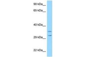 Image no. 1 for anti-Ribosomal Protein S2 (RPS2) (AA 99-148) antibody (ABIN6748128) (RPS2 Antikörper  (AA 99-148))