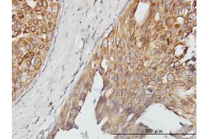 Image no. 1 for anti-Alveolar Soft Part Sarcoma Chromosome Region, Candidate 1 (ASPSCR1) (AA 1-554) antibody (ABIN466238) (ASPSCR1 Antikörper  (AA 1-554))