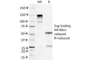 SDS-PAGE Analysis Purified Serum Amyloid A Mouse Monoclonal Antibody (SAA/326). (SAA Antikörper)