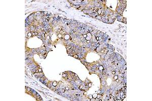 IHC analysis of STON1 using anti-STON1 antibody (ABIN7599896).