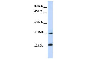 AP3S1 antibody used at 1 ug/ml to detect target protein.