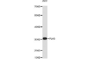 Western blot analysis of extracts of 293T cells, using PLK5 antibody (ABIN6293956) at 1:3000 dilution. (PLK5 Antikörper)