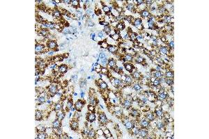 Immunohistochemistry of paraffin-embedded rat liver using HSP Rabbit mAb (ABIN7267580) at dilution of 1:100 (40x lens). (HSPA4 Antikörper)