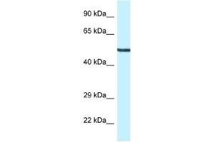 Western Blot showing Map2k5 antibody used at a concentration of 1. (MAP2K5 Antikörper  (N-Term))