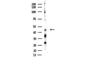 Western blot analysis of lysates from F10-LUC cells(starvation 24h treatment), using PTPN2 Antibody at 1/1000 dilution.