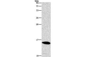 Western blot analysis of Mouse brain tissue, using CST4 Polyclonal Antibody at dilution of 1:1450 (CST4 Antikörper)