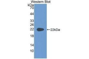 Detection of Recombinant KRT4, Rat using Monoclonal Antibody to Cytokeratin 4 (CK4) (KRT4 Antikörper  (AA 317-454))