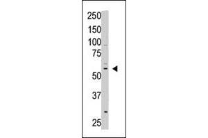 The CREB3L1 polyclonal antibody  is used in Western blot to detect CREB3L1 in A-375 cell lysate. (CREB3L1 Antikörper  (C-Term))