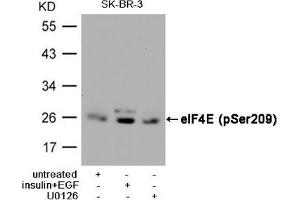 Western blot analysis of extracts from SK-BR-3 cells, untreated or insulin and EGF treated, and pretreated with U0126 cells, using eIF4E (Phospho-Ser209) Antibody. (EIF4E Antikörper  (pSer209))