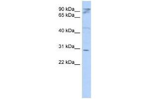 HAX1 antibody used at 1 ug/ml to detect target protein. (HAX1 Antikörper  (Middle Region))