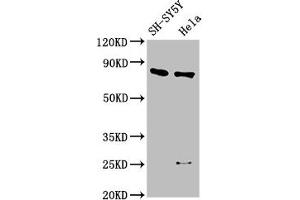 Western Blot Positive WB detected in: SH-SY5Y whole cell lysate, Hela whole cell lysate All lanes: CTNNB1 antibody at 2. (CTNNB1 Antikörper  (AA 2-781))