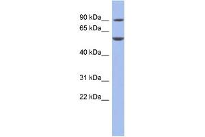 WB Suggested Anti-FOXC1 Antibody Titration:  0.