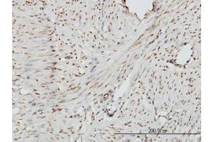 Image no. 1 for anti-Zinc Fingers and Homeoboxes 2 (ZHX2) (AA 691-789) antibody (ABIN599184) (ZHX2 Antikörper  (AA 691-789))
