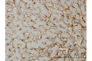 Image no. 1 for anti-EH-Domain Containing 3 (EHD3) (AA 357-407) antibody (ABIN599233) (EHD3 Antikörper  (AA 357-407))
