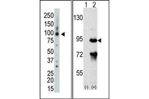 Image no. 1 for anti-rho GTPase Activating Protein 26 (ARHGAP26) (Middle Region) antibody (ABIN360552) (GRAF Antikörper  (Middle Region))