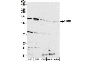 anti-URB2 Ribosome Biogenesis 2 Homolog (URB2) (AA 1474-1524) antibody