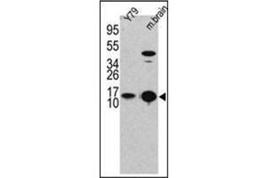 Western blot analysis of LC3B Antibody (LC3B Antikörper  (N-Term))