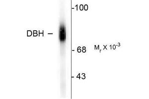 Image no. 1 for anti-Dopamine beta-Hydroxylase (Dopamine beta-Monooxygenase) (DBH) (C-Term) antibody (ABIN372611) (DBH Antikörper  (C-Term))