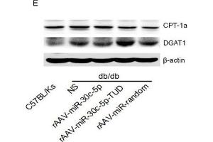 rAAV-miR-30c-5p attenuated hepatic steatosis in db/db mice(A and B) Histological analysis of hepatocyte by H&E and Oil Red O staining. (beta Actin Antikörper)