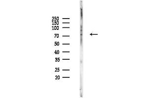 anti-Protein Kinase C, delta (PKCd) (pSer645) antibody