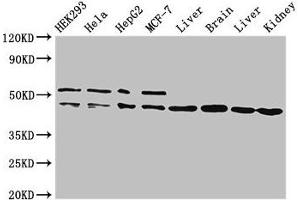 Western Blot Positive WB detected in: HEK293 whole cell lysate, Hela whole cell lysate, HepG2 whole cell lysate, MCF-7 whole cell lysate, Rat liver tissue, Mouse brain tissue, Mouse liver tissue, Mouse kidney tissue All lanes: IDH1 antibody at 2 μg/mL Secondary Goat polyclonal to rabbit IgG at 1/50000 dilution Predicted band size: 47 kDa Observed band size: 47, 52 kDa (IDH1 Antikörper  (AA 1-240))
