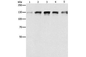 Western Blot analysis of Human fetal small intestine, liver cancer and Lymphoma Lymphoma, 293T and A549 cell using DDB1 Polyclonal Antibody at dilution of 1:500 (DDB1 Antikörper)