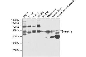 Western blot analysis of extracts of various cell lines, using P2RY2 antibody (ABIN6132453, ABIN6145128, ABIN6145130 and ABIN6218094) at 1:1000 dilution. (P2RY2 Antikörper  (AA 278-377))