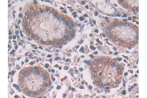DAB staining on IHC-P; Samples: Human Stomach Tissue (CBL Antikörper  (AA 558-816))