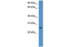 Mouse Kidney; WB Suggested Anti-Chodl Antibody Titration: 0. (CHODL Antikörper  (C-Term))