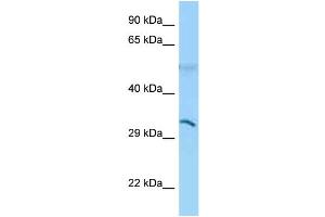 WB Suggested Anti-CD1B Antibody Titration: 1. (CD1b Antikörper  (N-Term))
