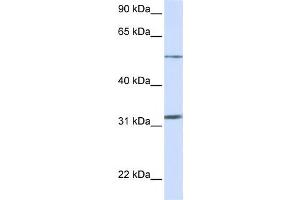 Western Blotting (WB) image for anti-Solute Carrier Family 35, Member A5 (SLC35A5) antibody (ABIN2458797) (SLC35A5 Antikörper)