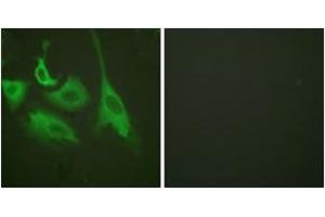Immunofluorescence analysis of HeLa cells treated with TNF-a 20nM 15', using HSP90B (Phospho-Ser254) Antibody. (HSP90AB1 Antikörper  (pSer254))
