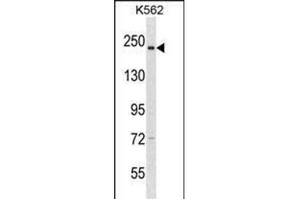 NCAPD3 Antikörper  (C-Term)