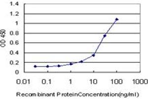 anti-serpin Peptidase Inhibitor, Clade A (Alpha-1 Antiproteinase, Antitrypsin), Member 10 (SERPINA10) (AA 22-444) antibody
