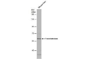 WB Image Mouse tissue extract (50 μg) was separated by 7. (TKT Antikörper)