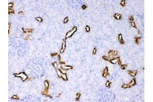 Cytokeratin 18 was detected in paraffin-embedded sections of rat kidney tissues using rabbit anti- Cytokeratin 18 Antigen Affinity purified polyclonal antibody (Catalog # ) at 1 µg/mL. (Cytokeratin 18 Antikörper  (AA 204-430))